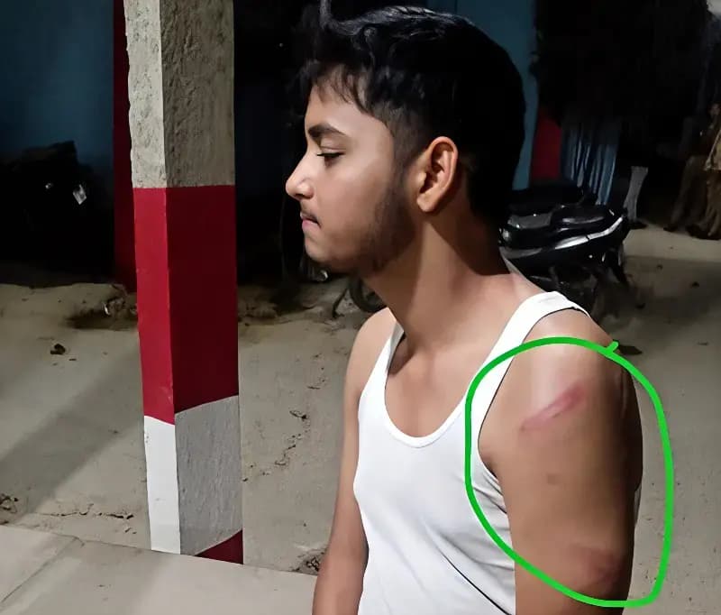 Chandauli News: बाजार में किशोर पर हमला, बचाने पहुंचे लोगों से भी मारपीट.
